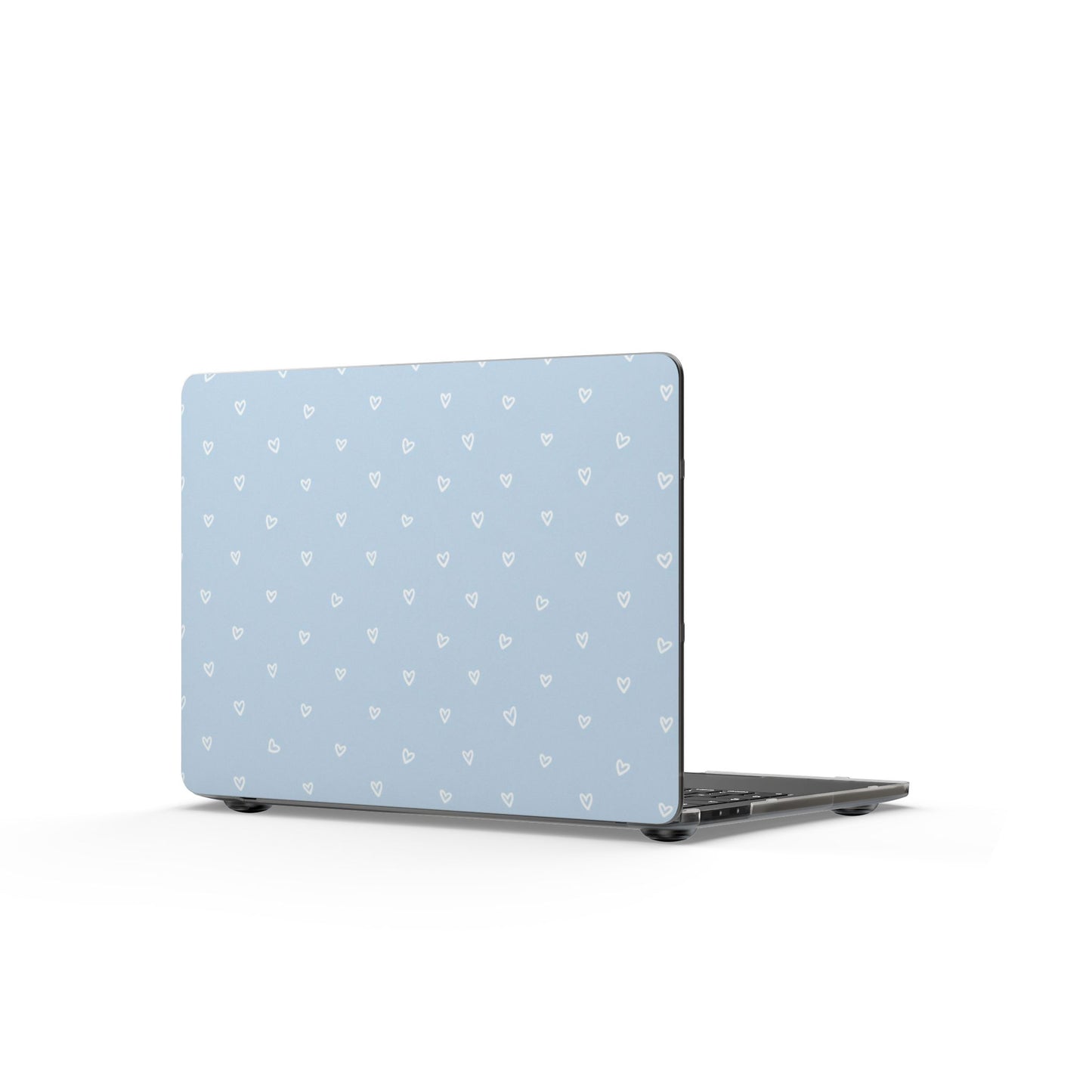 🤍 The Enchanted Sky Blue™ MacBook Case 🤍