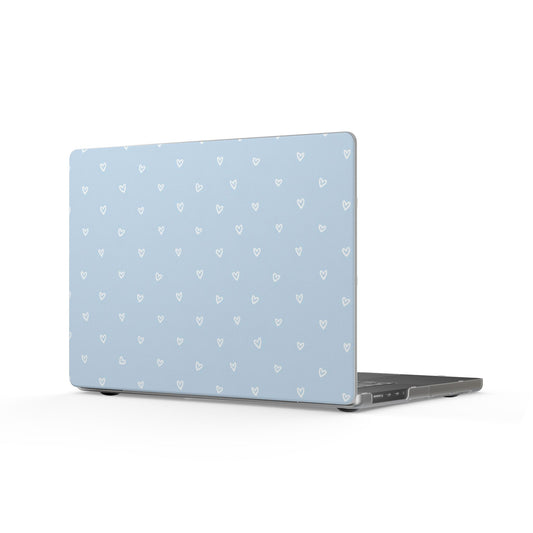 🤍 The Enchanted Sky Blue™ MacBook Case 🤍